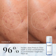 Press & Clear™ (Travel Size)