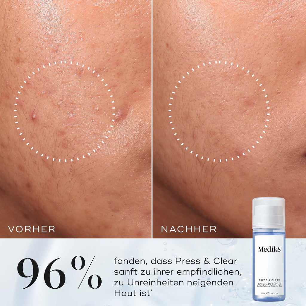 Press & Clear Refill™