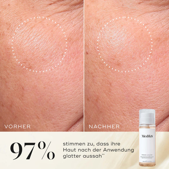 Nahaufnahme der Wange einer Teilnehmerin vor und nach der Anwendung, die eine glattere Textur und ein gleichmäßigeres Erscheinungsbild zeigt. Die Medik8 Press & Glow-Tonikflasche ist in der Ecke zu sehen. Der Text hebt hervor: „97 % stimmen zu, dass ihre Haut nach der Anwendung glatter aussah.“-hover-11