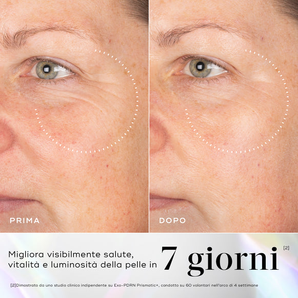 Immagini prima e dopo della pelle che mostrano rughe visibili nel contorno occhi, con miglioramenti evidenziati dopo l'uso del siero Medik8 Exo-PDRN Prismatic+.-hover-8