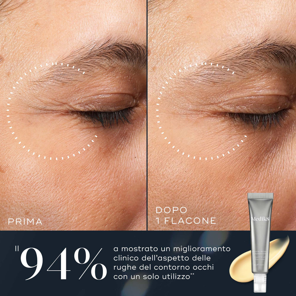 Un confronto ravvicinato "Prima e Dopo" della zona degli occhi di una persona. Il lato "Prima" mostra linee sottili e rughe visibili; il lato "Dopo 1 Flacone" mostra una pelle significativamente più liscia. Il testo afferma che il 94% ha mostrato un miglioramento clinico delle rughe con un solo utilizzo.