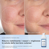 Niacinamide Peptides™