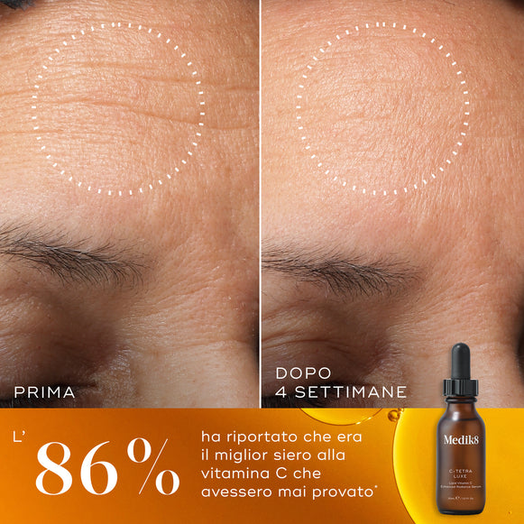 Confronto prima e dopo della fronte di una partecipante nell'arco di 4 settimane accanto a un flacone di siero Medik8 C-Tetra Luxe. Il testo in italiano evidenzia che l'86% ha riportato che era il miglior siero alla vitamina C che avessero mai provato.-hover-1